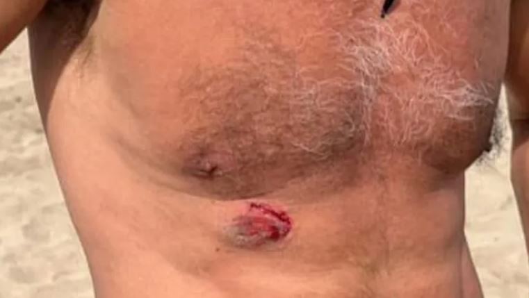 Denunció que fue mordido por un vendedor ambulante y tuvo un final inesperado | Actualidad