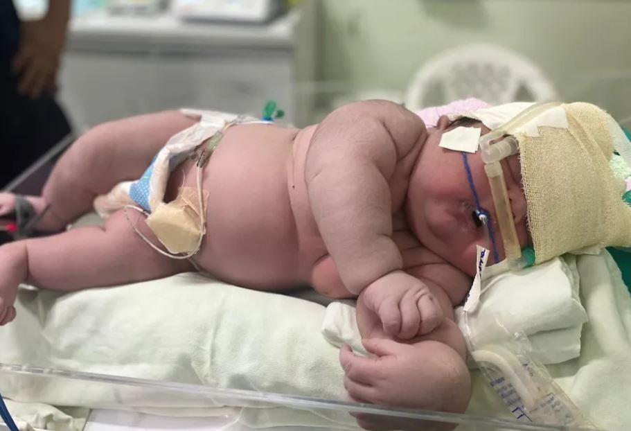 "Bebé gigante": nació una niña de más de 7 kilos en Brasil y rompió un récord | Internacionales