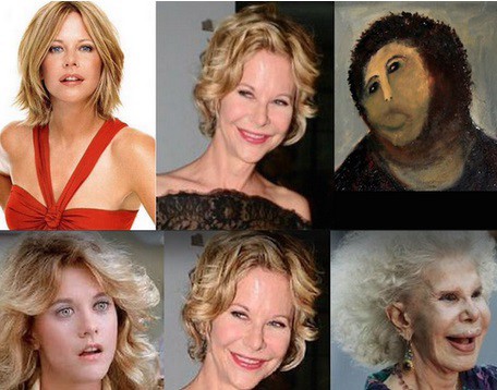 Los mejores memes de la nueva cara de Meg Ryan | Espectáculos