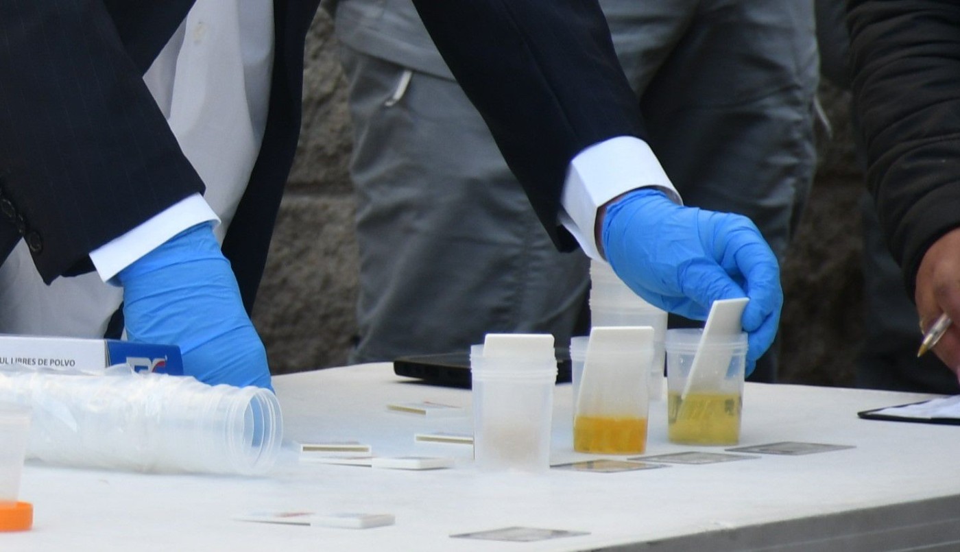 El kirchnerismo propone el test antidoping para funcionarios del Estado | Política