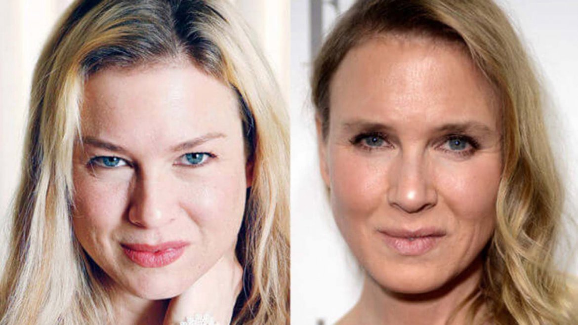 Los rostros de las estrellas antes y después de las cirugías | Espectáculos