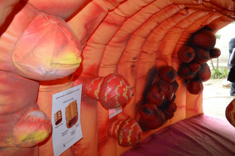 Instalan un colon inflable gigante para concientizar sobre la prevención del cáncer colorrectal | Actualidad