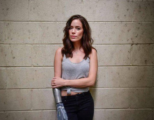 Rebekah Marine, la modelo con un "brazo biónico" que desfilará en Nueva York | Curiosidades