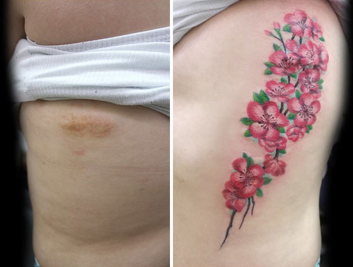 La historia de la artista que hace tatuajes sobre cicatrices de mujeres que sufrieron violencia de género | Curiosidades