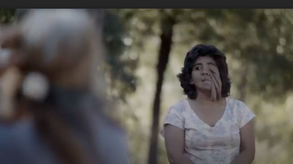 Pasó toda su vida encerrada en su casa sin salir por una rara enfermedad: a los 32 años todo cambió | Actualidad