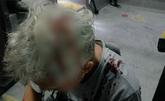 Línea 161: le pegaron un culatazo a una pasajera durante un asalto | Actualidad