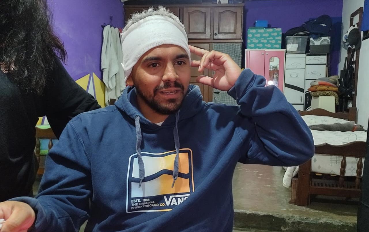 Le disparan en la cabeza para robarle el celular: está vivo de milagro | Actualidad