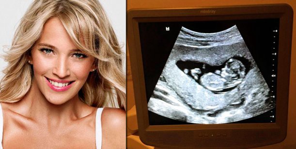 La primera ecografía del bebé que espera Luisana Lopilato | Espectáculos