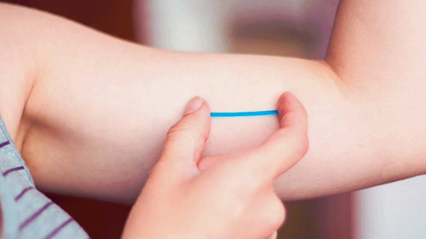 Salta: Colocarán implantes subdérmicos anticonceptivos a mujeres de hasta 19 años | Actualidad