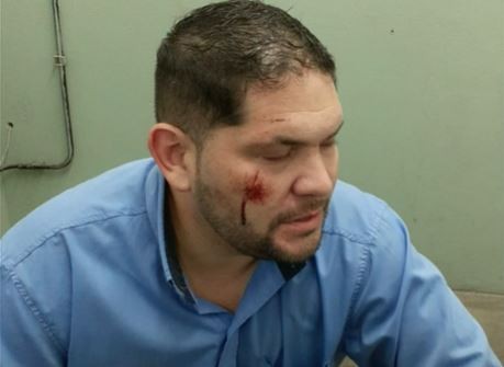 Robaron y golpearon a un chofer de La Perlita en Moreno | Actualidad