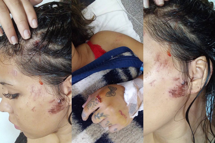 Video: atropelló a una chica a la salida de un boliche y huyó | Actualidad