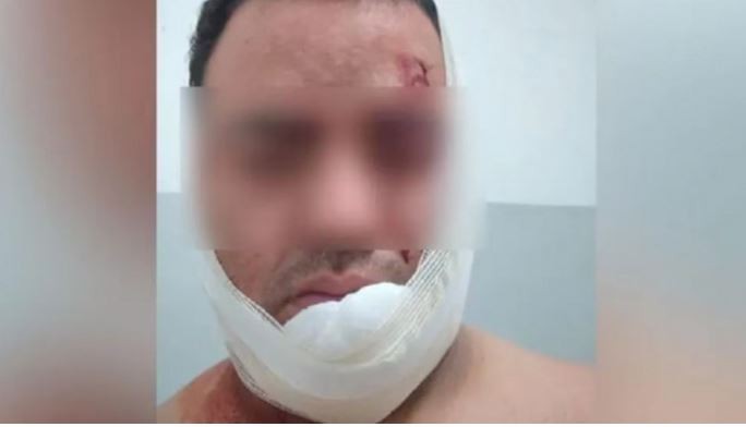 Violento robo a un taxista de ladrones que se hicieron pasar por pasajeros: “Me cortaron el cuello” | Actualidad