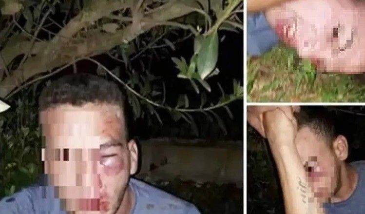 Grooming: pactó un encuentro con una adolescente, la familia de ella lo engañó y lo lincharon | Actualidad