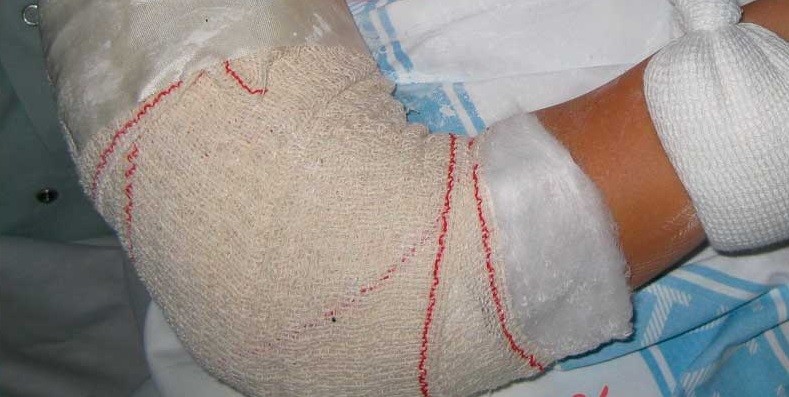 Indemnización: condenan a "frentista" por el accidente que sufrió una mujer por la vereda en mal estado | Actualidad