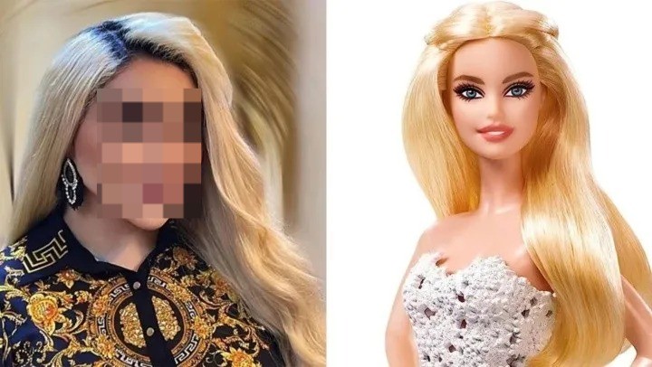 Impactante: se hizo 43 cirugías para parecerse a Barbie | Internacionales