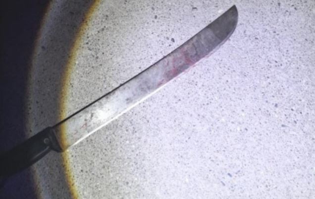 Encontró a un ladrón en el garaje de su casa y le amputó varios dedos a machetazos | Actualidad