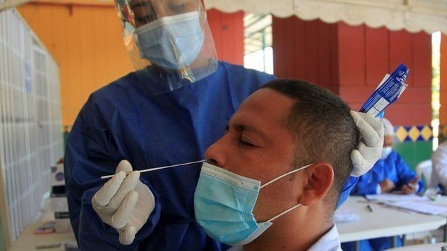 Detectan en Argentina una nueva cepa del Covid que crece a gran velocidad | Actualidad