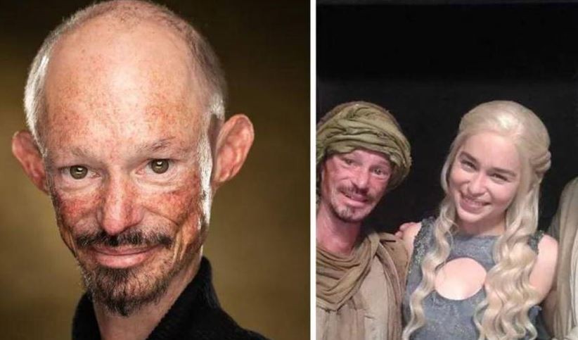 Murió a los 36 años Darren Kent, actor de "Games of Thrones" | Espectáculos