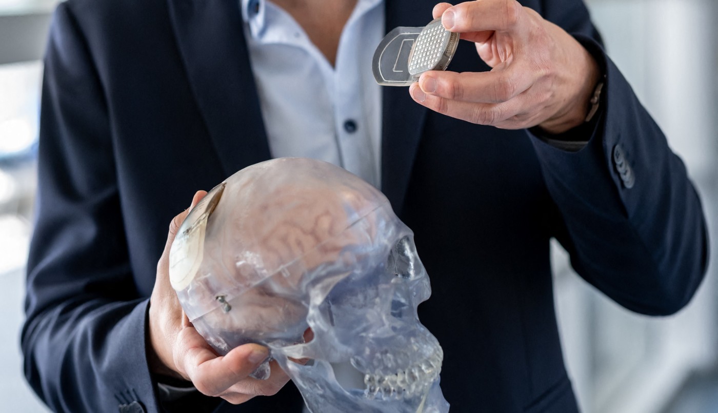 Implantes cerebrales: la carrera hacia el cíborg cobra impulso | Actualidad