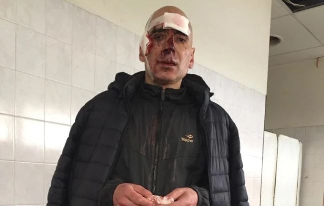 Dos motociclistas golpearon salvajemente a un maratonista: "Fueron directamente a matarme" | Actualidad