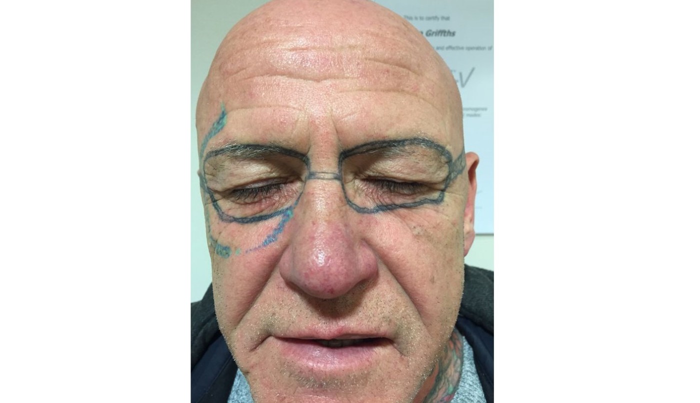 Tras una noche de fiesta  y alcohol, se despertó con anteojos tatuados en la cara | Curiosidades