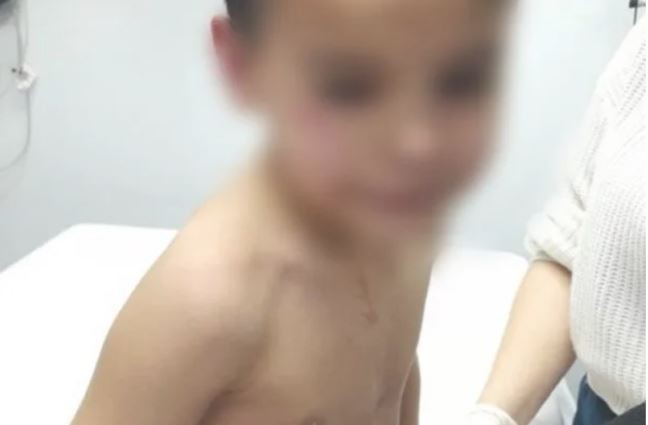 Le disparó a un nene de seis años tras una pelea que había tenido con su papá en un partido de fútbol amateur | Actualidad