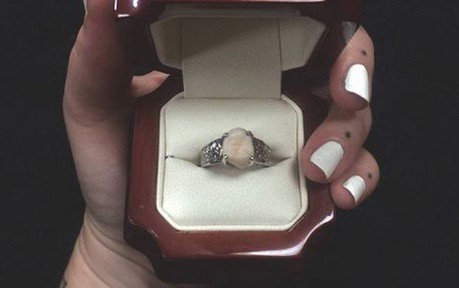 Le propuso casamiento a la novia con un anillo hecho con su muela de juicio | Curiosidades