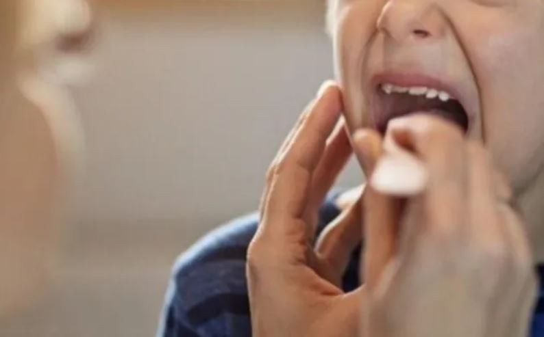 Streptococcus pyogenes: reportaron 487 casos en el país, con 78 fallecimientos | Actualidad