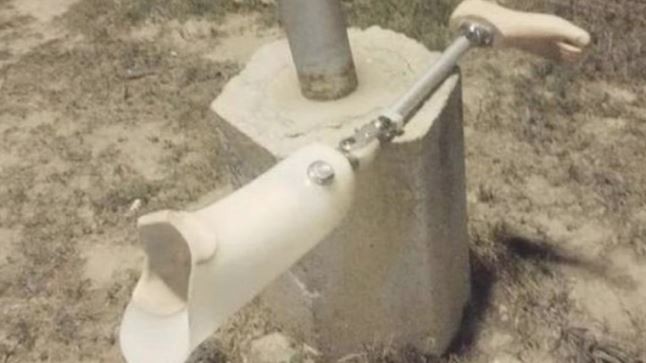 Se emborrachó, perdió su pierna ortopédica y la encontró dos días después | Actualidad