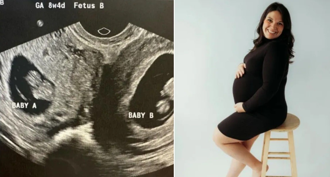 Mujer con inusual útero doble está embarazada en ambos | Internacionales