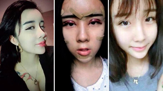 La chica que se operó toda para reconquistar a su novio | Curiosidades