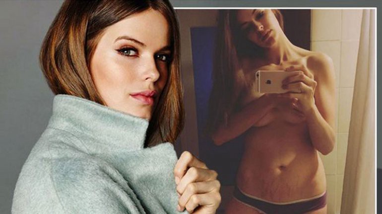 Modelo de Sports Illustrated mostró sus estrías en una foto de topless | Espectáculos