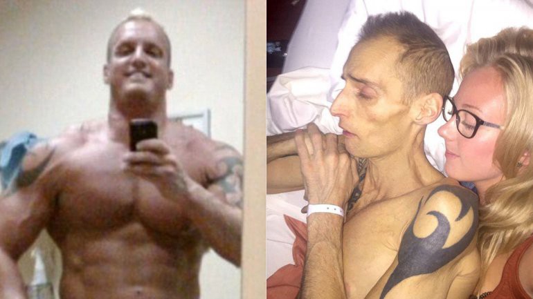 El hombre que se obsesionó con su cuerpo y terminó muriendo de cáncer | Curiosidades