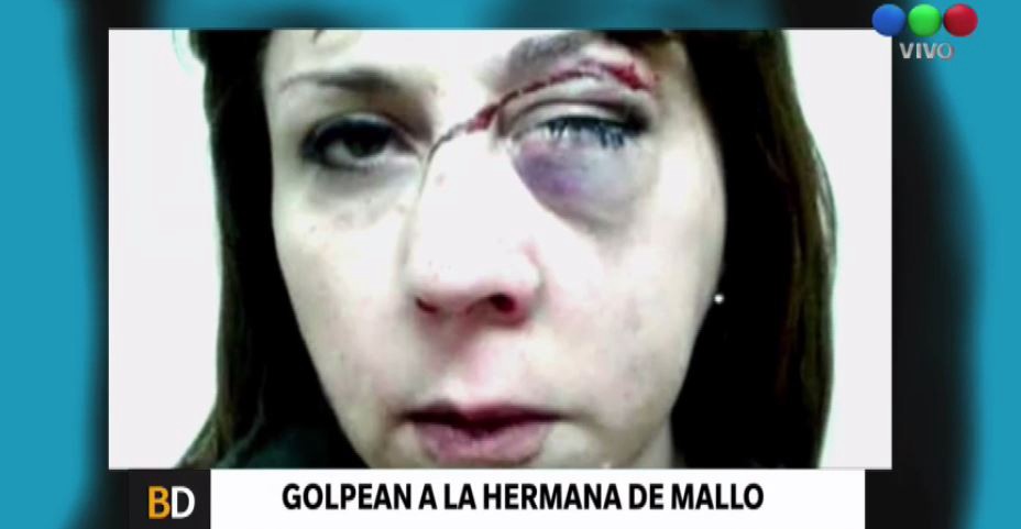 Sospechoso asalto a la hermana del barrabrava prófugo Marcelo Mallo | Deportes
