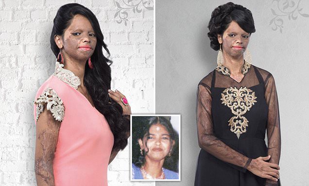 La desfiguraron con ácido y ahora es modelo de una marca de ropa | Curiosidades