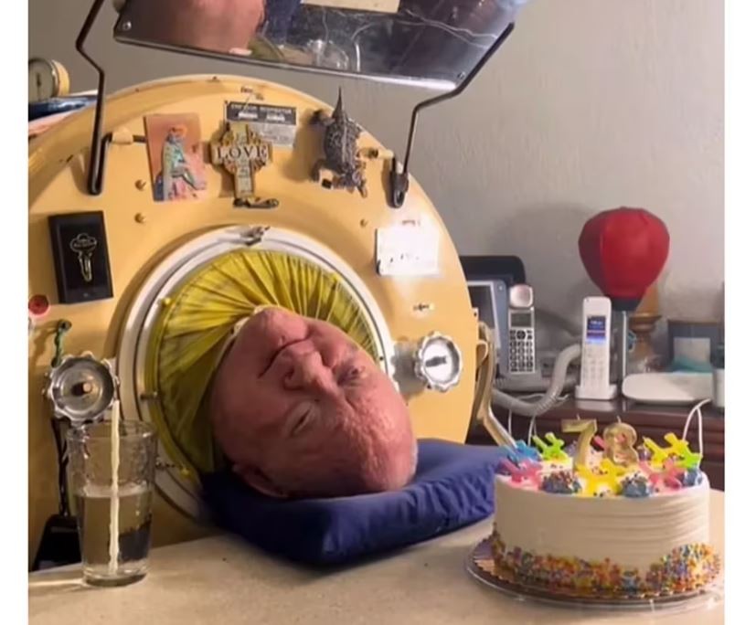Murió Paul Alexander, el hombre que vivió durante más de 70 años conectado a un pulmón de hierro | Curiosidades