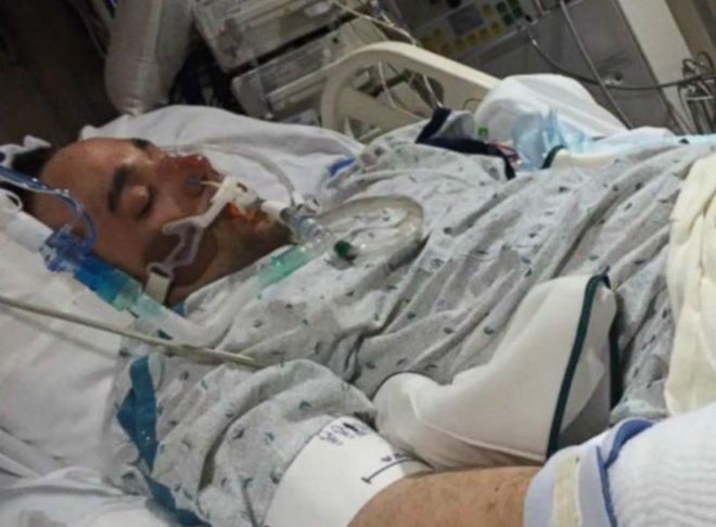 La increíble historia del hombre "que murió congelado y regresó de la muerte" | Curiosidades