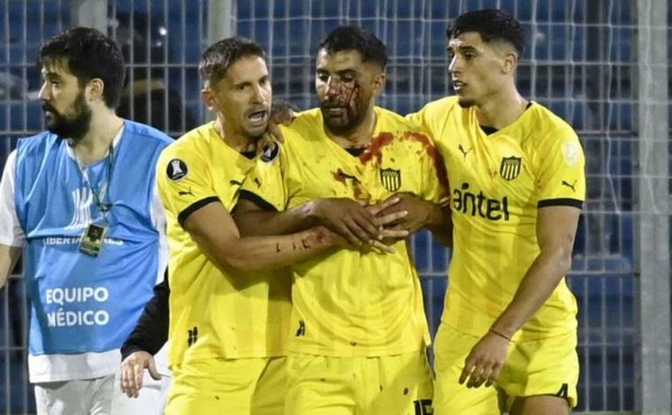 Detuvieron al plateísta de Central que le tiró el piedrazo a Olivera | Deportes