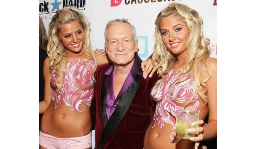 Las conejitas mellizas ex novias de Hugh Hefner, luchan contra el sobrepeso | Espectáculos