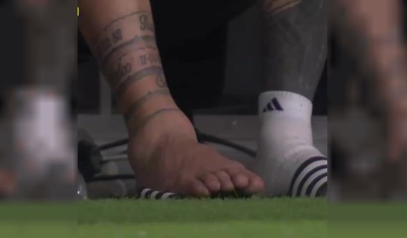 Tremendo: así quedó el tobillo de Messi | Deportes