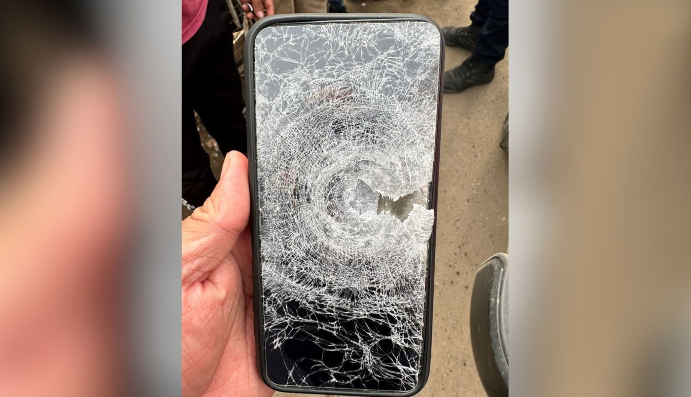 Le dispararon a un joven en la pierna y se salvó gracias al celular | Actualidad