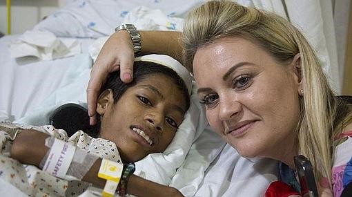 El drama del nene que no puede sostener su cabeza | Curiosidades