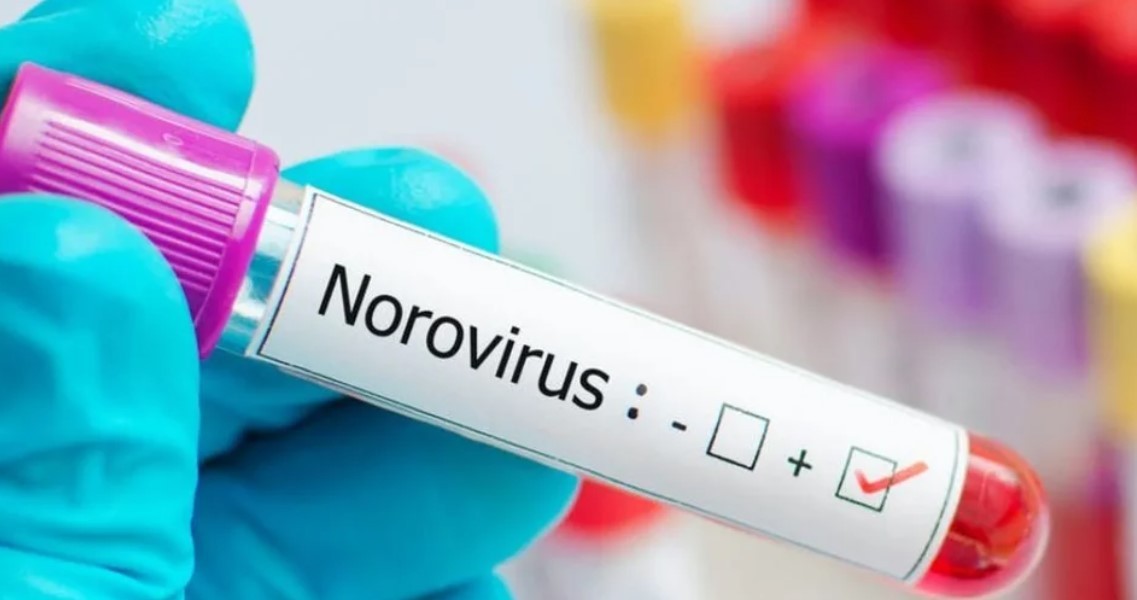 Qué es el norovirus, la enfermedad que afectó a 180 estudiantes en Bariloche | Actualidad