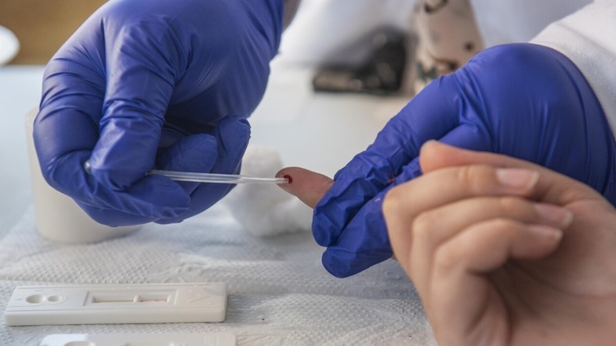 Seis pacientes trasplantados dan positivo de VIH tras recibir órganos infectados en Río de Janeiro | Internacionales