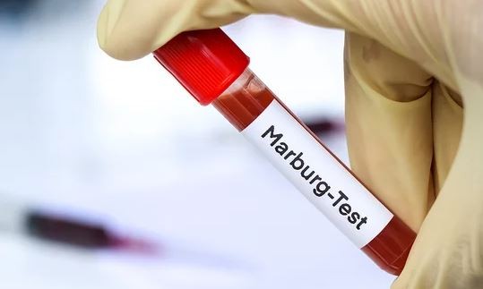 Murieron ocho personas por posible brote de la enfermedad del virus de Marburgo en Tanzania | Internacionales