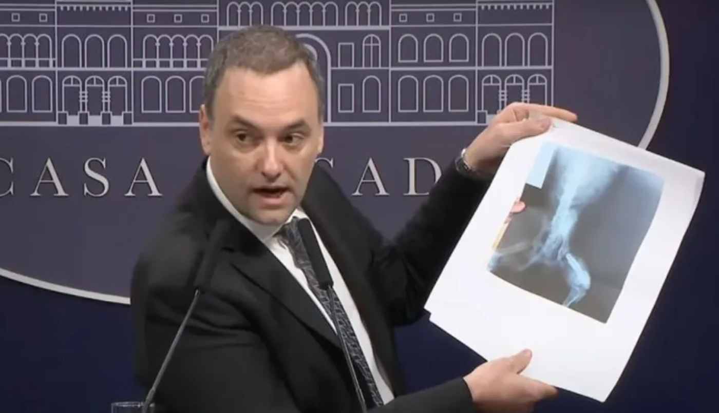 Por irregularidades, el Gobierno comienza a auditar más de un millón de pensiones de Anses por invalidez | Actualidad