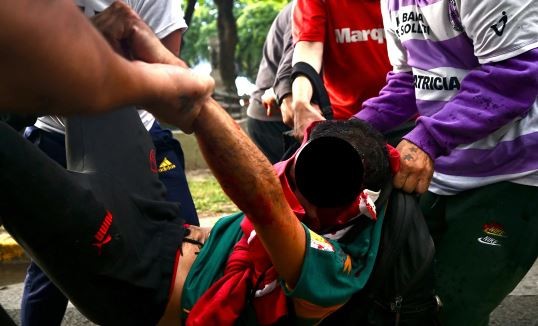 Piden dadores de sangre para el fotógrafo atacado por policías en la marcha de jubilados | Actualidad