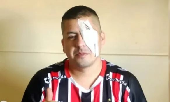 Un hincha de Chacarita denunció a Patricia Bullrich tras perder un ojo por la represión en el Congreso | Actualidad