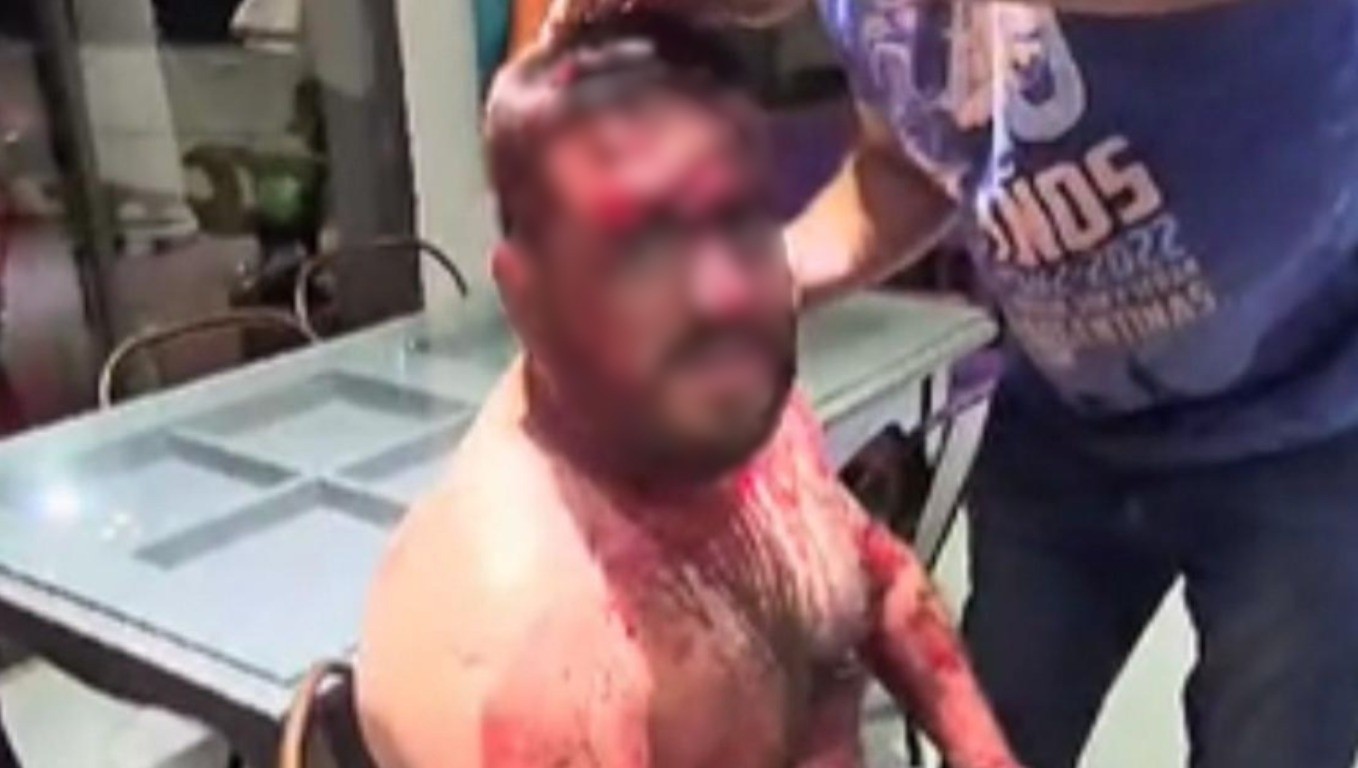 Violento robo en un country de Córdoba: lo golpearon tanto que perdió dos litros de sangre | Actualidad