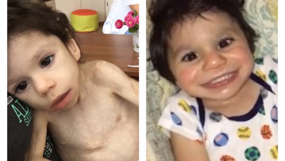 La increible recuperación de un nene de 7 años que pesaba 3 kilos y fue adoptado | Curiosidades